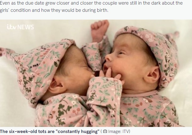 生後6週になった“奇跡の双子”（画像は『The Mirror　2022年4月22日付「British couple welcome ‘miracle’ conjoined twins who ‘constantly hug each other’」（Image: ITV）』のスクリーンショット）