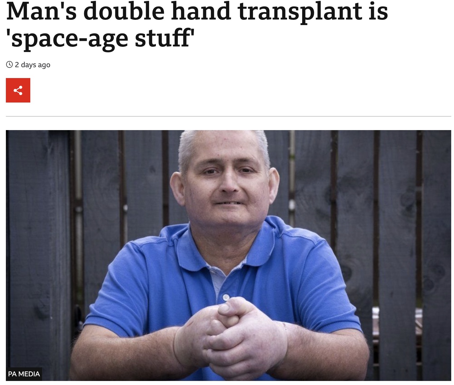 ドナーへの感謝を述べたスティーブンさん（画像は『BBC News　2022年5月26日付「Man’s double hand transplant is ‘space-age stuff’」（PA MEDIA）』のスクリーンショット）