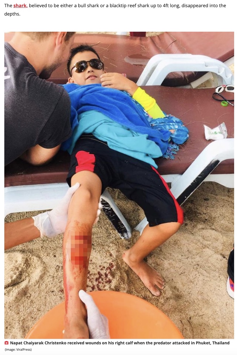 右ふくらはぎに傷を負ったナパト君（画像は『The Daily Star　2022年5月4日付「Boy, 8, punches shark in the face to survive horror beach attack」（Image: ViralPress）』のスクリーンショット）