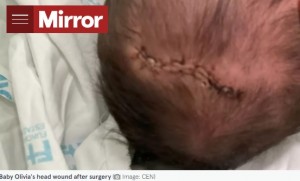 頭を11針も縫う怪我だった（画像は『The Mirror　2022年5月16日付「Newborn forced to get 11 stitches after she fell out of pregnant mum head first」（Image: CEN）』のスクリーンショット）