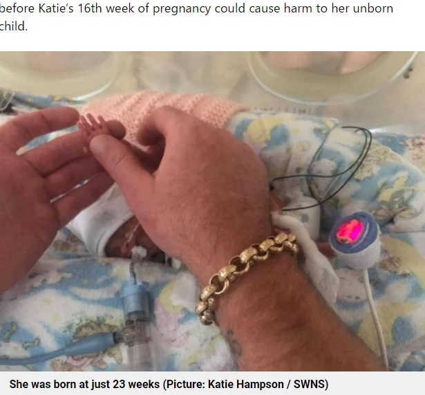 父の親指の爪と同じ大きさの女児の手（画像は『Metro　2022年5月8日付「‘Miracle’ tiny baby born at just 23 weeks had hands the size of her dad’s fingernail」（Picture: Katie Hampson / SWNS）』のスクリーンショット）