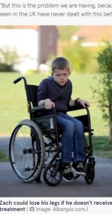 治療をしないと一生、車椅子生活の可能性も（画像は『The Mirror　2022年4月25日付「Boy, 9, who ‘can’t feel any pain’ walked with broken leg for THREE DAYS」（Image: Albanpix.com）』のスクリーンショット）