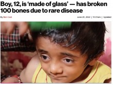 【海外発！Breaking News】ガラスのような骨で100か所以上の骨折、身体中が折れ曲がった12歳少年（印）＜動画あり＞