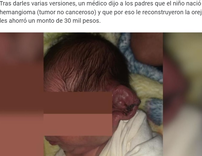 耳を切り落とされそうになった男児（画像は『Reporte Indigo　2022年6月16日付「Realizan cesárea sin luz en Mexicali y cortan oreja de recién nacido; familia denuncia negligencia」』のスクリーンショット）