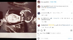 順調に成長している胎児（画像は『Ashley Ness　2022年6月22日付Instagram「The girls（C＆D）are already ready for the camera」』のスクリーンショット）
