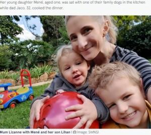 【海外発！Breaking News】体重60kgの飼い犬に顔を噛みちぎられた1歳女児　「娘は言葉が出なくなった」と母親（南ア）
