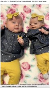 生後6か月を迎えたミラちゃんとレーガンちゃん（画像は『Metro　2022年7月19日付「Twin born almost three times smaller than her sister defies the odds and is now ‘thriving’」（Picture: Audrienna Lambert/SWNS）』のスクリーンショット）