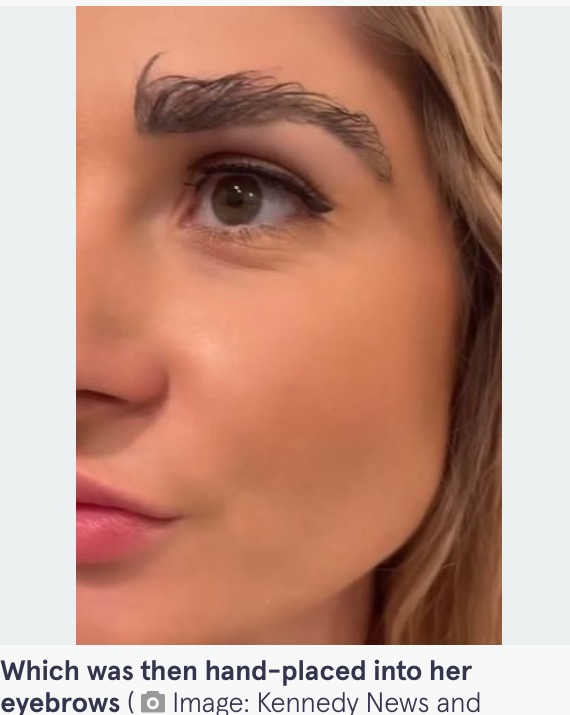 どんどん伸びてくる眉毛（画像は『The Mirror　2022年7月6日付「Woman gets eyebrow transplant with hair from head - but now has to keep cutting them」（Image: Kennedy News and Media）』のスクリーンショット）