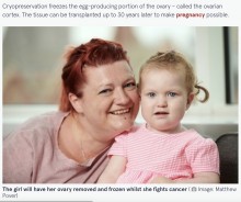 【海外発！Breaking News】脳腫瘍と闘う1歳女児の卵巣組織を凍結保存　「いつかママになれるように」と母親（英）