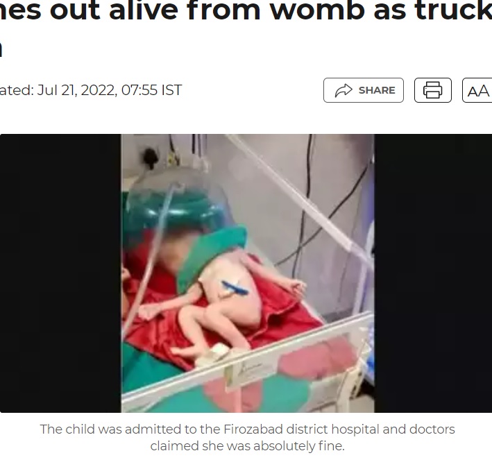 病院でケアを受ける女児（画像は『Times of India　2022年7月21日付「UP: Baby comes out alive from womb as truck crushes mom」』のスクリーンショット）