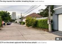 【海外発！Breaking News】2歳男児、近所の犬に襲われ200針を縫う怪我　「門が開いていた」（タイ）＜動画あり＞