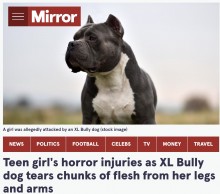 【海外発！Breaking News】友人宅の飼い犬に襲われた15歳少女、脚や腕を引き裂かれる（スコットランド）
