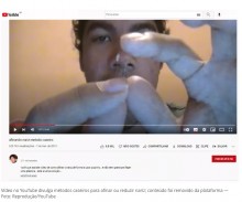【海外発！Breaking News】YouTubeを見て自分で鼻の整形手術をした男性、病院で緊急治療を受ける（ブラジル）＜動画あり＞