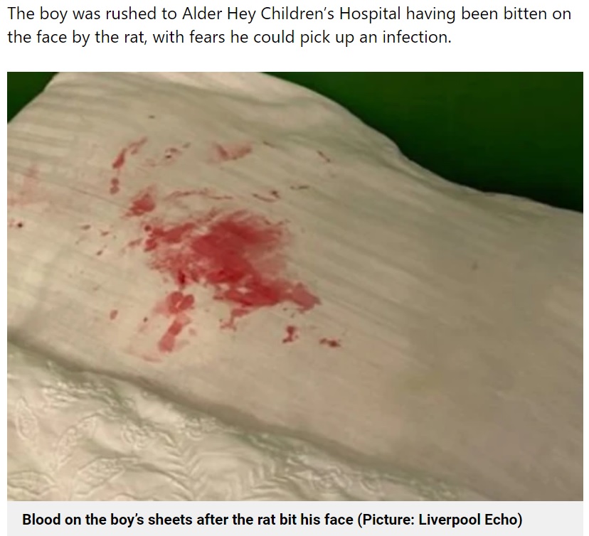 男児が使っていた枕には血痕が（画像は『Metro　2022年9月24日付「Rat bites sleeping toddler on his face leaving ‘horror movie’ scene in bedroom」（Picture: Liverpool Echo）』のスクリーンショット）