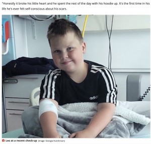 【海外発！Breaking News】見知らぬ若者に手術痕をからかわれた10歳少年　「傷痕はファイターである証」と母親（英）
