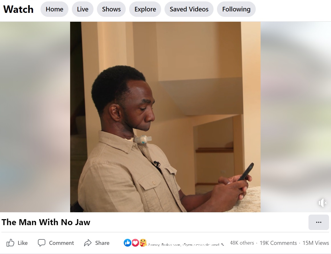 携帯電話でコミュニケーションを取るジョセフさん（画像は『Love Don’t Judge　2022年8月24日付Facebook「The Man With No Jaw」』のスクリーンショット）