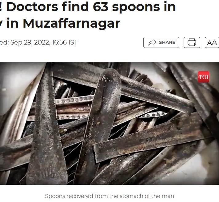 変色したスプーン（画像は『Times of India　2022年9月29日付「Stomach this! Doctors find 63 spoons in man’s tummy in Muzaffarnagar」』のスクリーンショット）