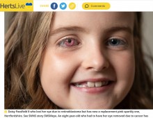 【海外発！Breaking News】右眼球を摘出した8歳女児、キラキラ輝くピンク色の義眼で“スーパーヒーロー”に（英）