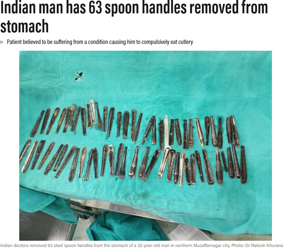 32歳の男性の胃から摘出されたスプーン（画像は『The National　2022年9月28日付「Indian man has 63 spoon handles removed from stomach」（Photo: Dr Rakesh Khurana）』のスクリーンショット）