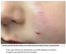 就寝中にネズミに頬を噛まれた2歳男児、枕の血痕に母親驚愕「まるでホラー映画」（英）