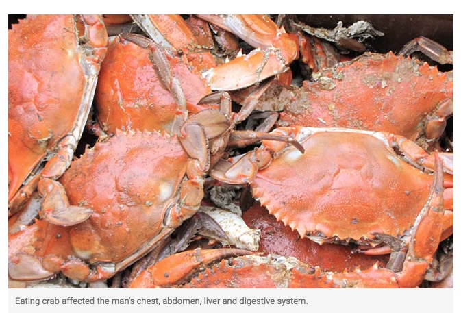 生のカニを食べて寄生虫に感染（画像は『NDTV.com　2022年10月28日付「Man In China Eats Live Crab As “Revenge” After It Pinched His Daughter: Report」』のスクリーンショット）