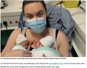 【海外発！Breaking News】予定日より3か月早く誕生した双子男児、数々の試練を乗り越え1歳を迎える（スコットランド）