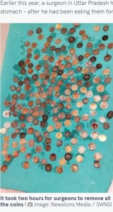 摘出された187枚の硬貨（画像は『The Mirror　2022年11月29日付「Doctors discover 187 coins in man’s stomach after he complained he was ‘bloated’」（Image: Newslions Media / SWNS）』のスクリーンショット）