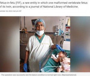 【海外発！Breaking News】新生児のお腹から不完全な胎児8体を摘出、「これまでで最多」と医師も驚愕（印）