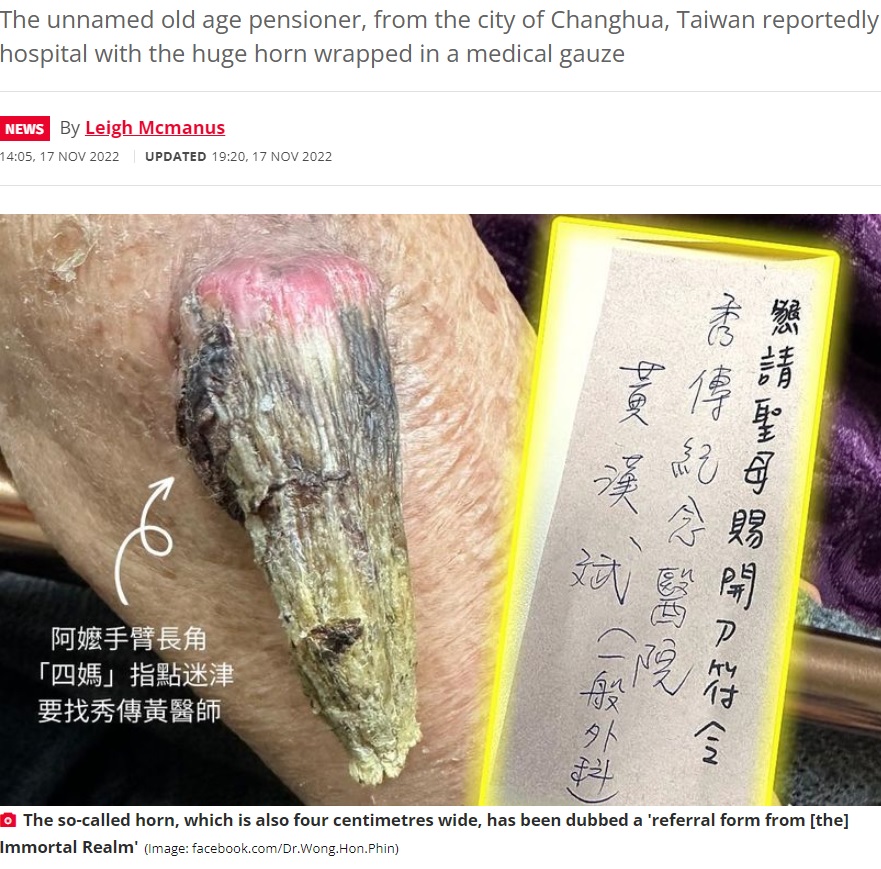 91歳の女性の右腕に生えた皮角と寺院からの紹介状（画像は『The Daily Star　2022年11月17日付「Grandmother, aged 91, has ultra-rare 7cm long ‘fairy’ horn growing on her arm」（Image: facebook.com/Dr.Wong.Hon.Phin）』のスクリーンショット）