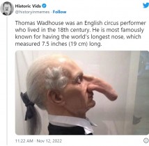 【海外発！Breaking News】「リアル・ピノキオ！」歴史上最も長い鼻の男性、イメージ画像に驚愕（英）