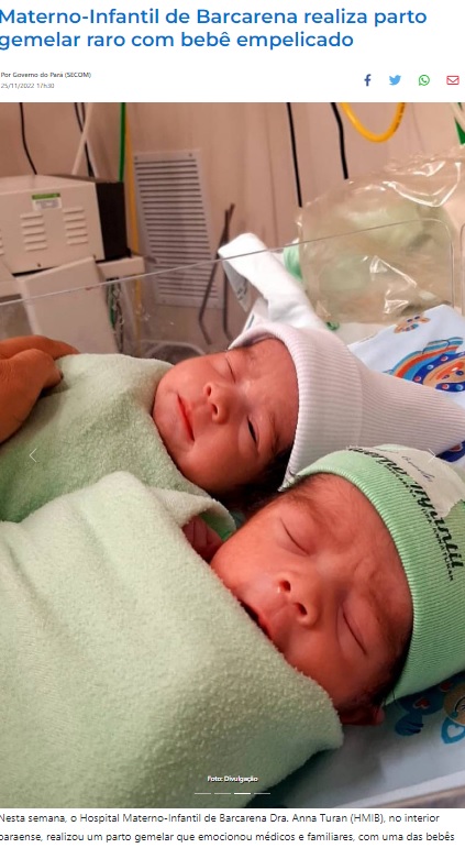 11月22日に誕生した双子姉妹（画像は『Agência Pará de Notícias　2022年11月25日付「Materno-Infantil de Barcarena realiza parto gemelar raro com bebê empelicado」（Foto: Divulgação）』のスクリーンショット）