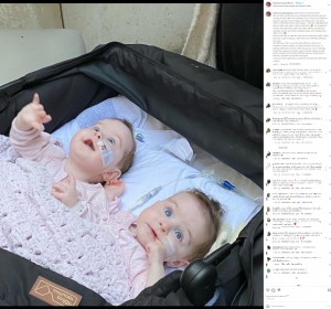 【海外発！Breaking News】結合双生児の姉妹の分離から1か月半、「希望が見えてきた」と母が写真公開（英）＜動画あり＞