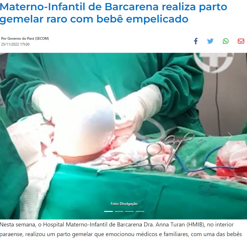 卵膜と羊水に包まれたままで誕生した赤ちゃん（画像は『Agência Pará de Notícias　2022年11月25日付「Materno-Infantil de Barcarena realiza parto gemelar raro com bebê empelicado」（Foto: Divulgação）』のスクリーンショット）
