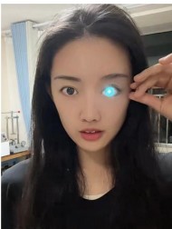【海外発！Breaking News】事故で片目を失った女性、自ら作った“光る義眼”で人気を博す（中国）＜動画あり＞