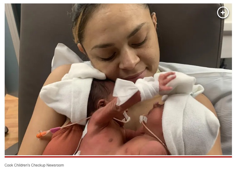 優しく双子を見守るアマンダさん（画像は『New York Post　2023年1月27日付「Infant conjoined twins successfully separated in ‘historic surgery’ at Texas hospital」（Cook Children’s Checkup Newsroom）』のスクリーンショット）