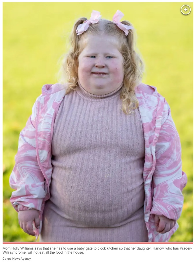 プラダー・ウィリー症候群の女児（画像は『New York Post　2023年1月24日付「My 5-year-old is obese ― I have to lock her out of the kitchen」（Caters News Agency）』のスクリーンショット）