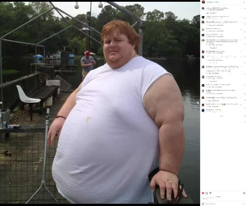 最も重い時で体重が383キロあったという男性（画像は『Casey King　2023年2月22日付Instagram』のスクリーンショット）