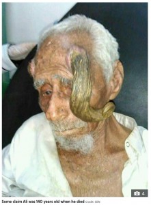 顔半分を覆うヒツジのような角（画像は『The Sun　2023年3月15日付「‘GOAT MAN’ DEAD ‘World’s oldest man’ with two horn-like growths on his head dies ‘aged 140’ days after botched operation to cut them off」（Credit: CEN）』のスクリーンショット）
