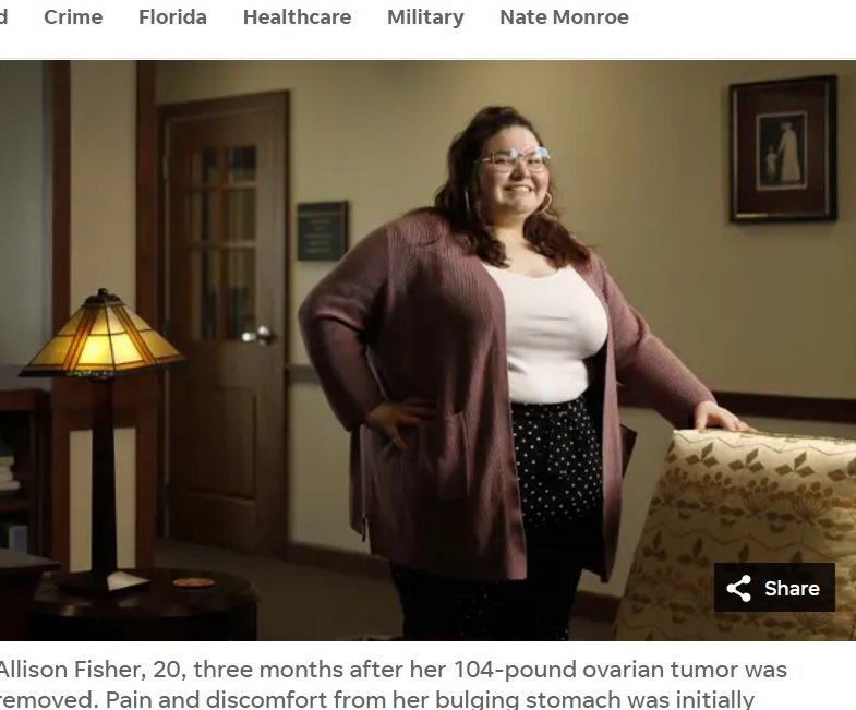 物心ついた頃からぽっちゃり体型で、体調が悪くても「肥満が原因」と診断されてきた20歳の女性。昨年12月に約47キロの卵巣腫瘍を摘出し「人間らしく生きられるようになった」と笑顔を見せる（画像は『Florida Times-Union　2023年3月28日付「‘Life-changing’ surgery: Doctors remove 104-pound tumor from woman in Florida」（BOB SELF/FLORIDA TIMES-UNION）』のスクリーンショット）