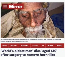 【海外発！Breaking News】「ヒツジ男」と呼ばれた推定140歳の男性、頭の“角”を切除後に死亡（イエメン）＜動画あり＞
