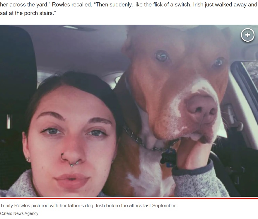 父親が飼っていた犬に襲われた女性（画像は『New York Post　2023年3月2日付「My dad’s dog bit off my nose ― now I have hair growing on my face」（Caters News Agency）』のスクリーンショット）