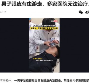 【海外発！Breaking News】瞼の下を蠢く糸状の寄生虫！　23歳男性、カメルーンで感染か（中国）＜動画あり＞