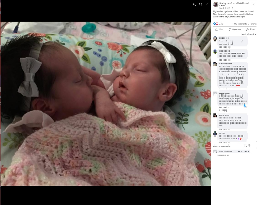 医師に「結合双生児が生きて誕生する確率は5％、誕生後に24時間以上生存できるのは2％」と中絶を勧められたものの、元気に誕生したカーリーちゃんとカーターちゃん。今は6歳になる（画像は『Beating the Odds with Callie and Carter　2017年3月1日付Facebook「Big brother Jaysin was able to meet his sisters!」』のスクリーンショット）