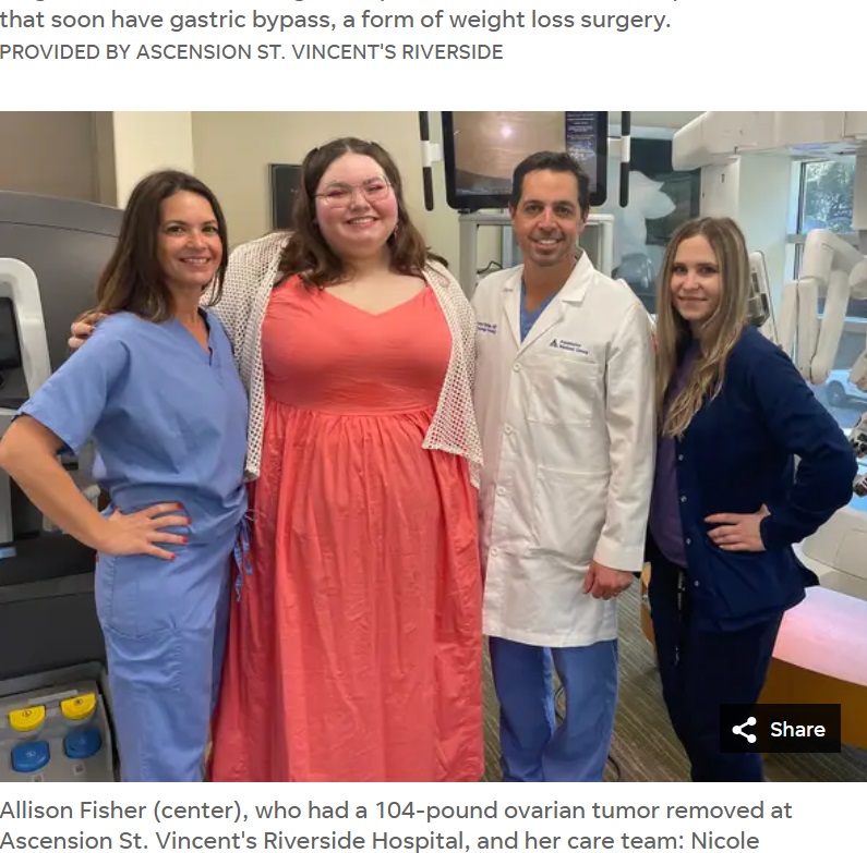 アセンション・セント・ビンセンツ・リバーサイド病院の婦人科腫瘍医のマーティン・マルティーノ氏（右から2番目）と手術後のアリソンさん（左から2番目）と手術をしたチームのメンバー。傷が小さく早期回復が期待できる“ロボットアーム”を使用した手術が行われ、見事成功（画像は『Florida Times-Union　2023年3月28日付「‘Life-changing’ surgery: Doctors remove 104-pound tumor from woman in Florida」（PHOTOS COURTESY OF ASCENSION ST. VINCENT’S RIVERSIDE）』のスクリーンショット）