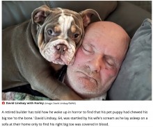 【海外発！Breaking News】糖尿病を患う64歳男性、飼い犬に噛まれたことで「つま先の麻痺」に気づく（英）