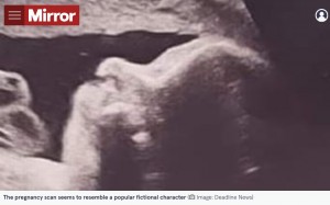 【海外発！Breaking News】超音波検査で赤ちゃんのそばに“クッキーモンスター”　妊婦が動揺（英）