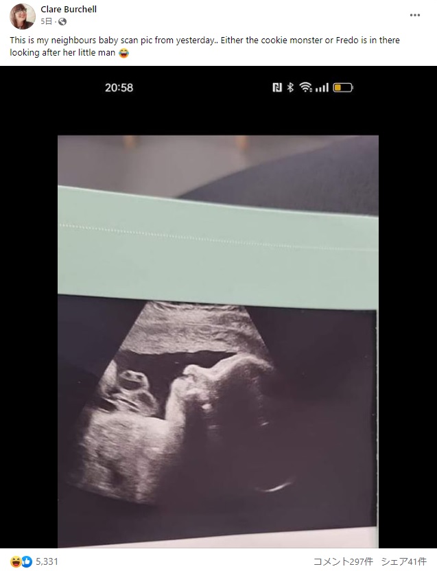 超音波検査でお腹の中の赤ちゃんと一緒に“クッキーモンスター”の姿が捉えられるも、その正体は臍の緒とのことだ（画像は『Clare Burchell　2023年4月5日付Facebook「This is my neighbours baby scan pic from yesterday..」』のスクリーンショット）