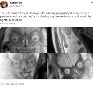 2021年5月にSNSでシェアされたMRI画像。ここに来て再び注目を浴び、「フェイクでは？」「怖い」「見なければよかった」といった声が寄せられた（画像は『Katie　2021年5月20日付Twitter「The real reason they discourage MRIs during pregnancy」』のスクリーンショット）