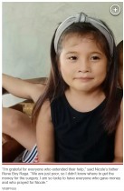 【海外発！Breaking News】きょうだい喧嘩中のアクシデント　9歳少女の額にハサミが突き刺さる（フィリピン）