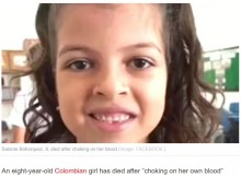 【海外発！Breaking News】歯科医院で抜歯した8歳女児が死亡　大量出血により窒息か（コロンビア）